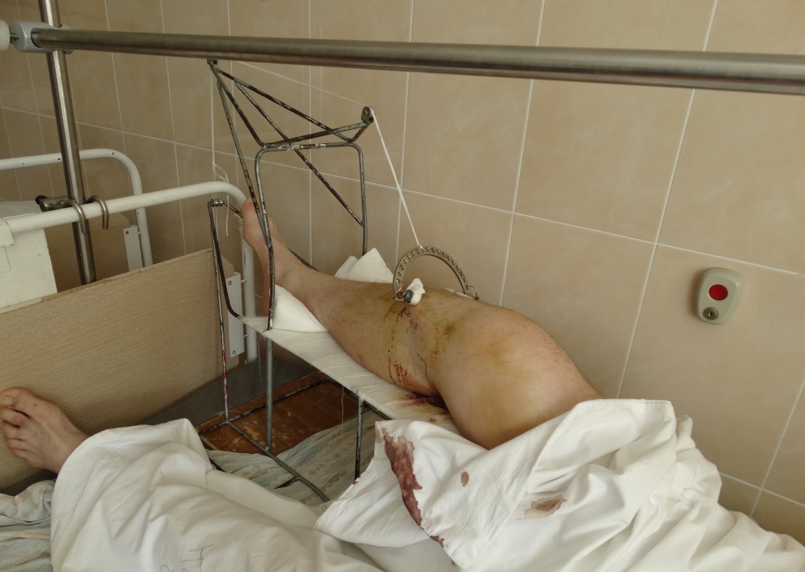 В Екатеринбурге попытка задержания велосипедиста сотрудником ГИБДД закончилась сломанной ногой