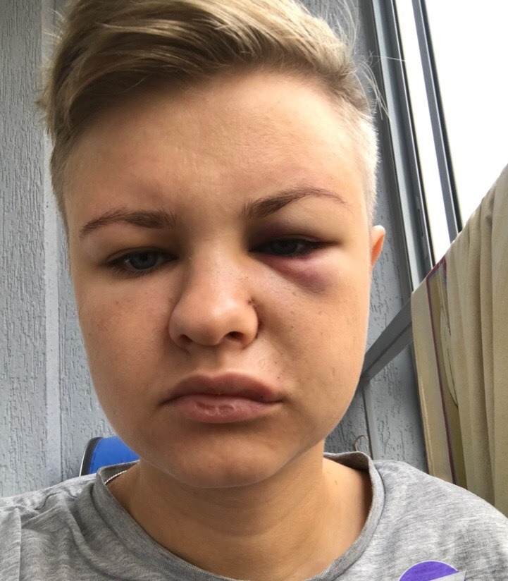 В Екатеринбурге полиция разыскивает мужчину, ударившего посетительницу гей-клуба